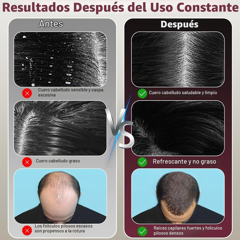 PEINE MASAJEADOR PARA CUERO CABELLUDO 3 EN 1